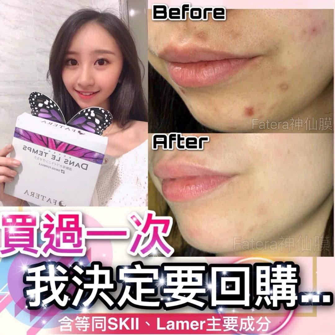 Fatera 神仙膜(白色) 5片/盒